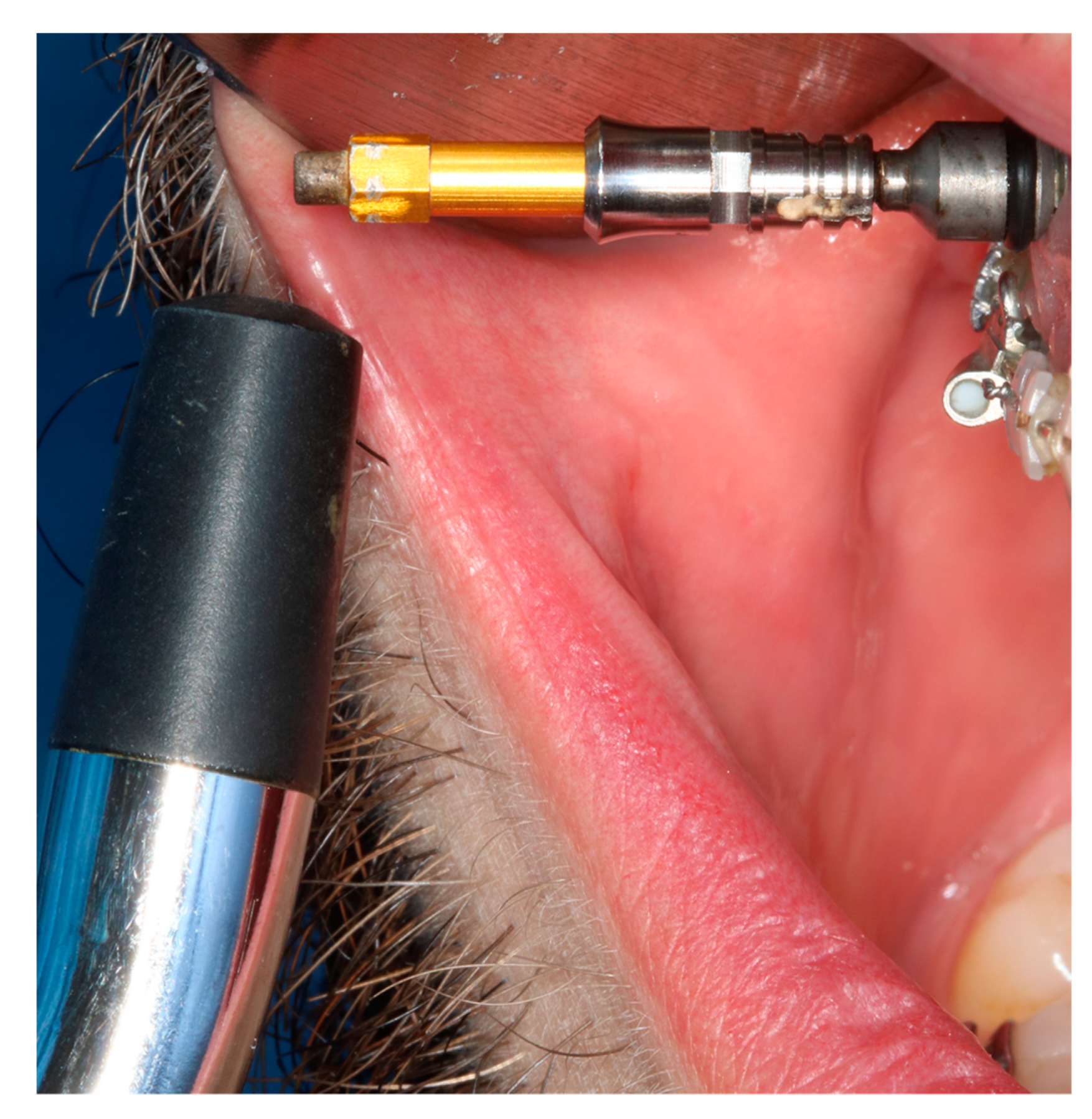 Applsci 13 08167 g005