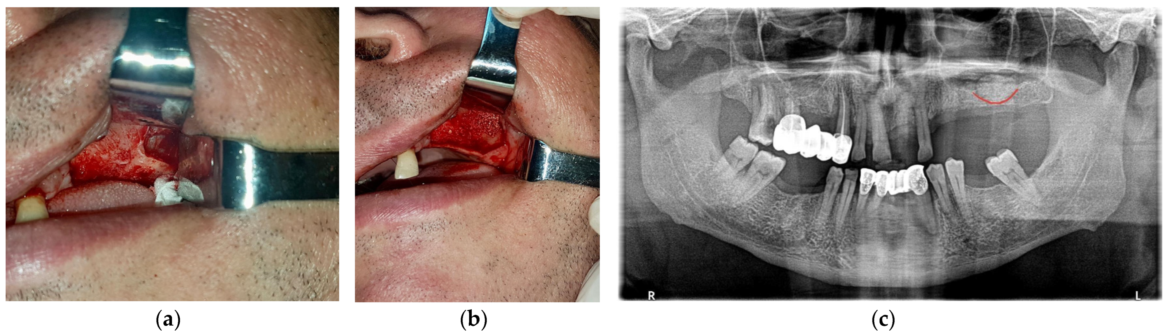 Applsci 13 08471 g001