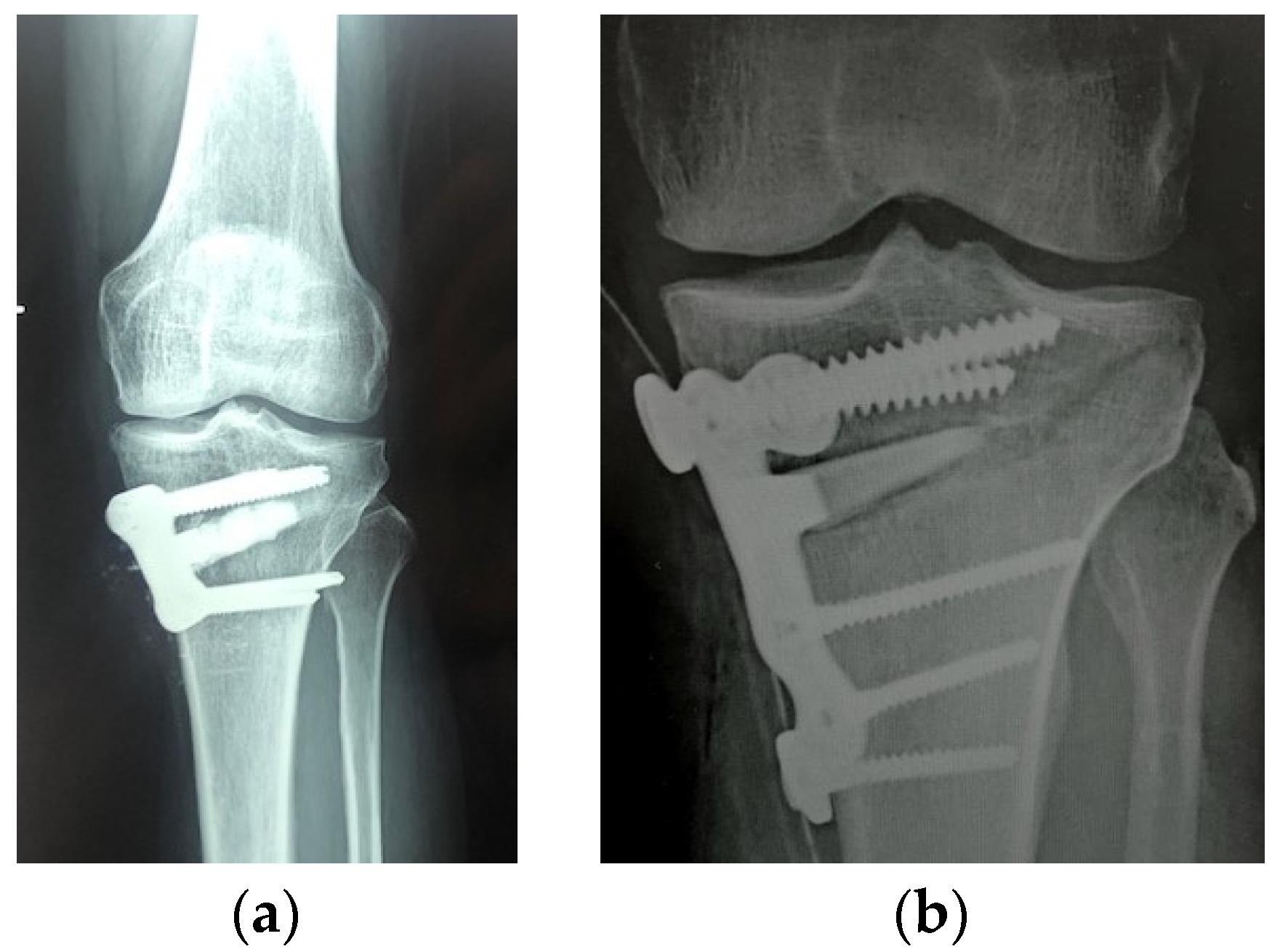 Applsci 13 08471 g004