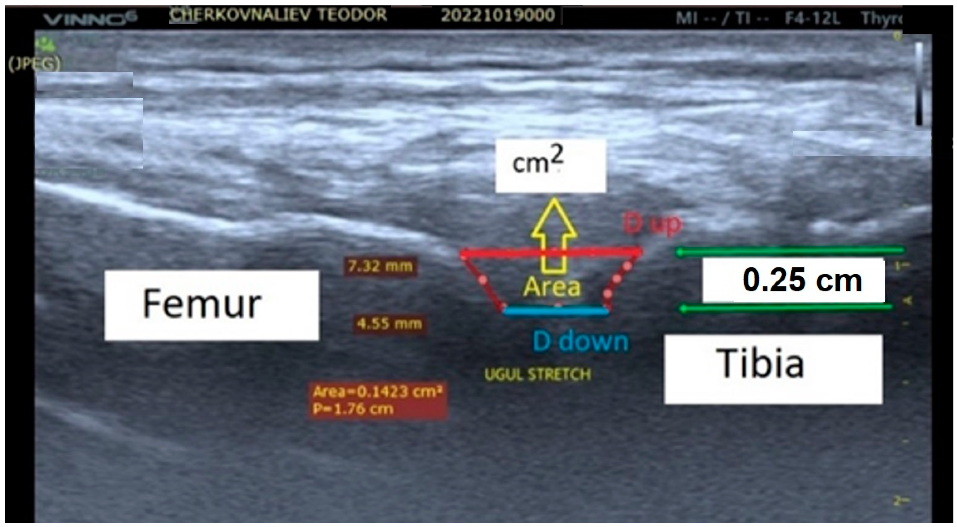 Applsci 13 08596 g001