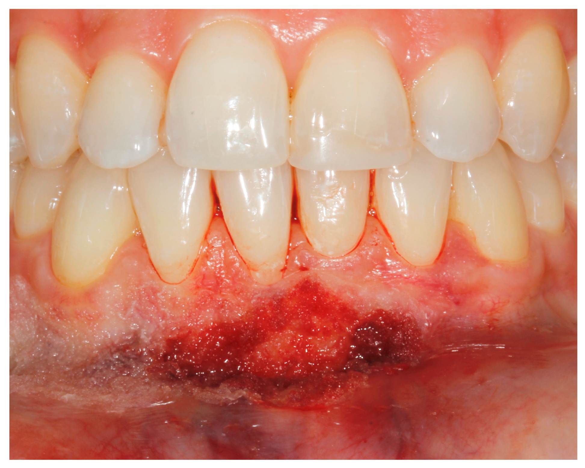 Applsci 13 08979 g005