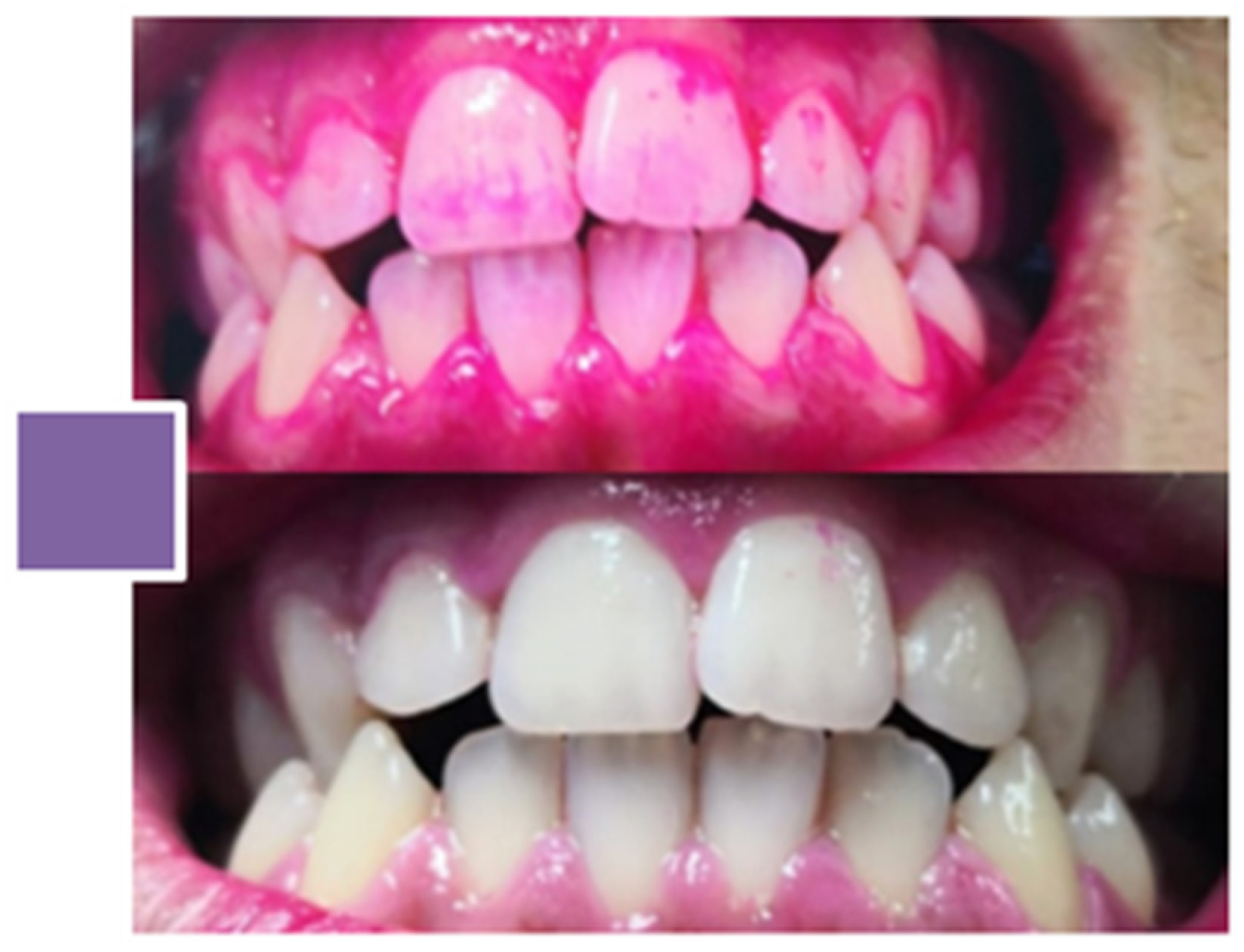 Applsci 13 09111 g013