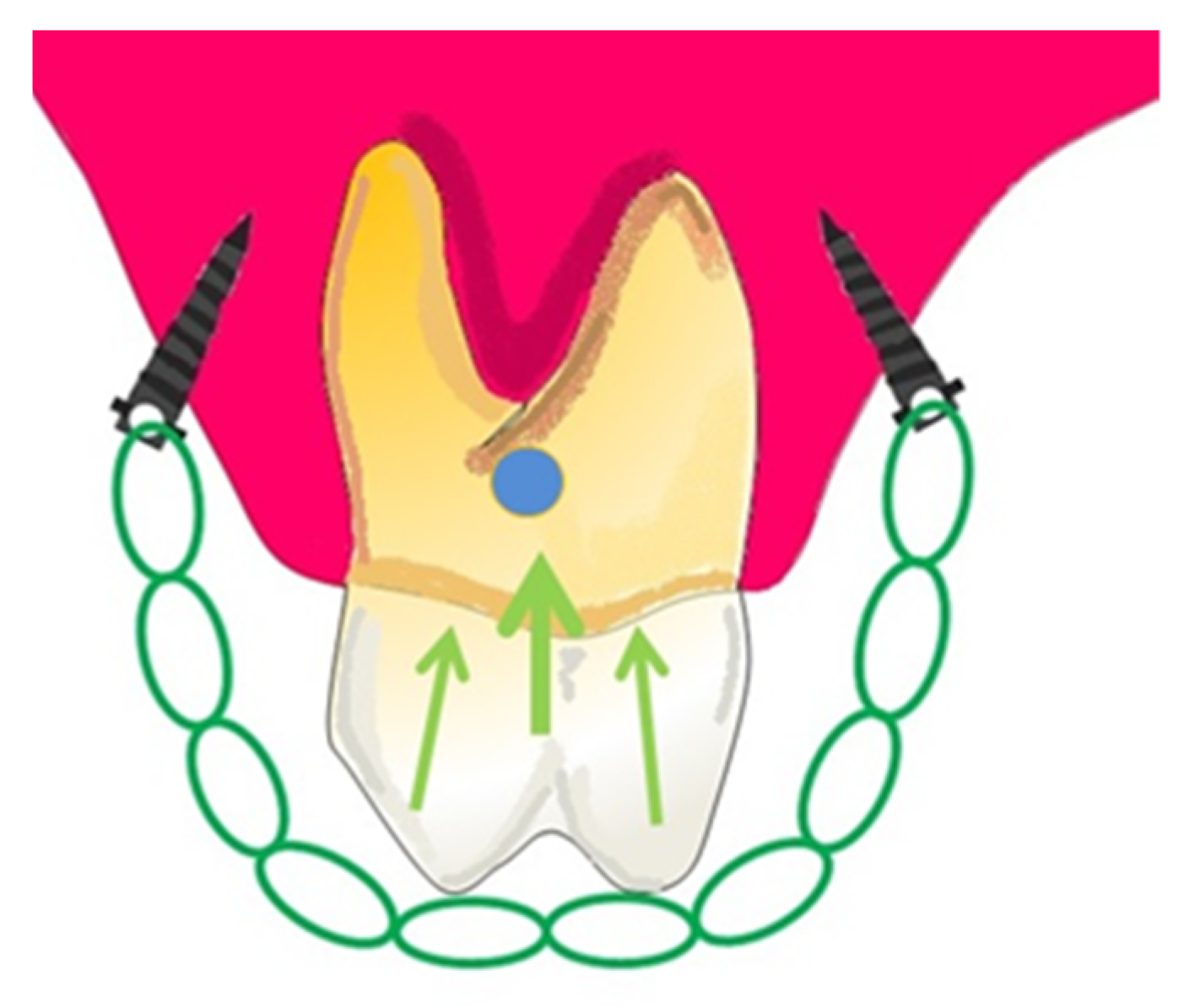 Applsci 13 09337 g006