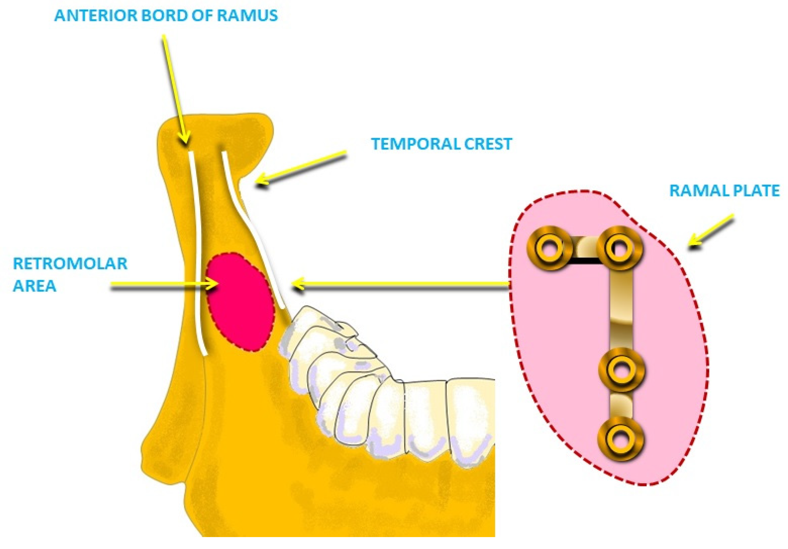 Applsci 13 09337 g008