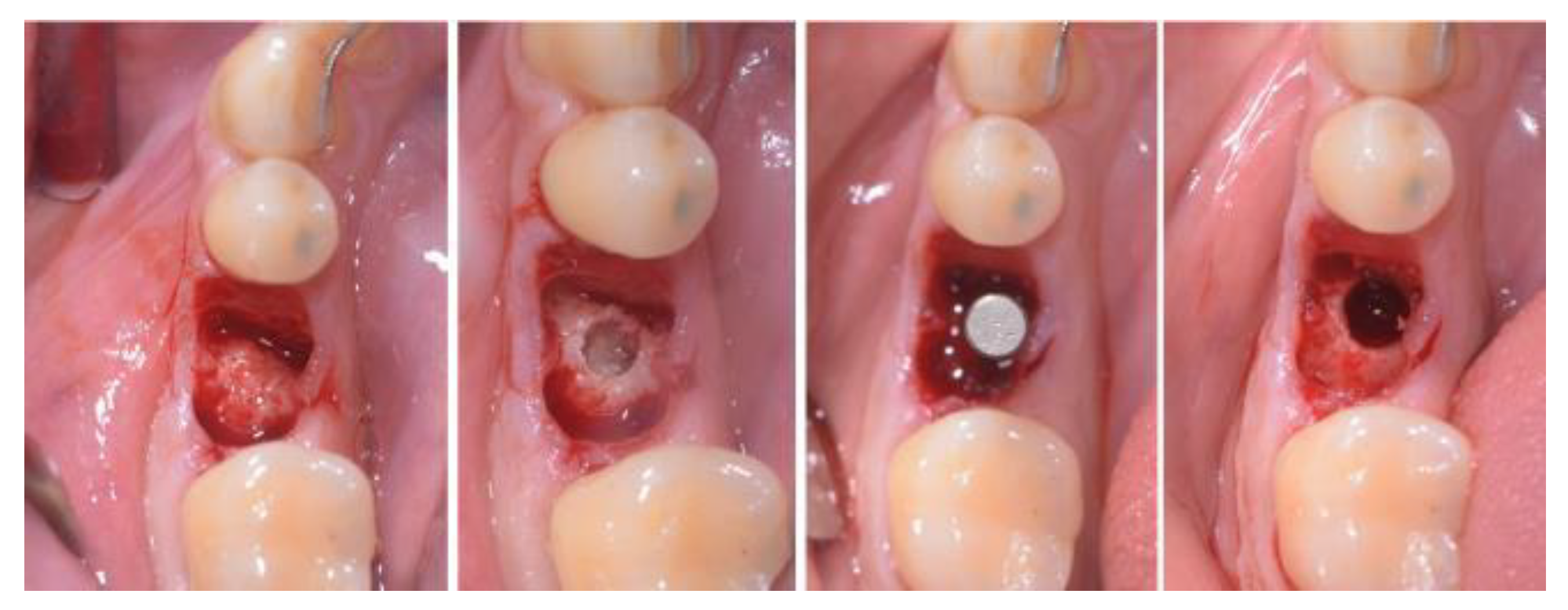 Applsci 13 09368 g002