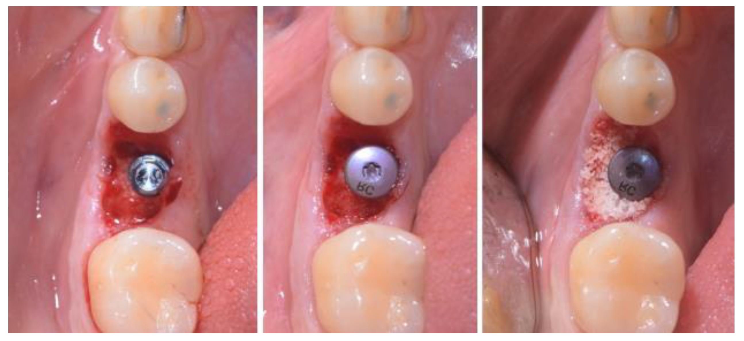 Applsci 13 09368 g003