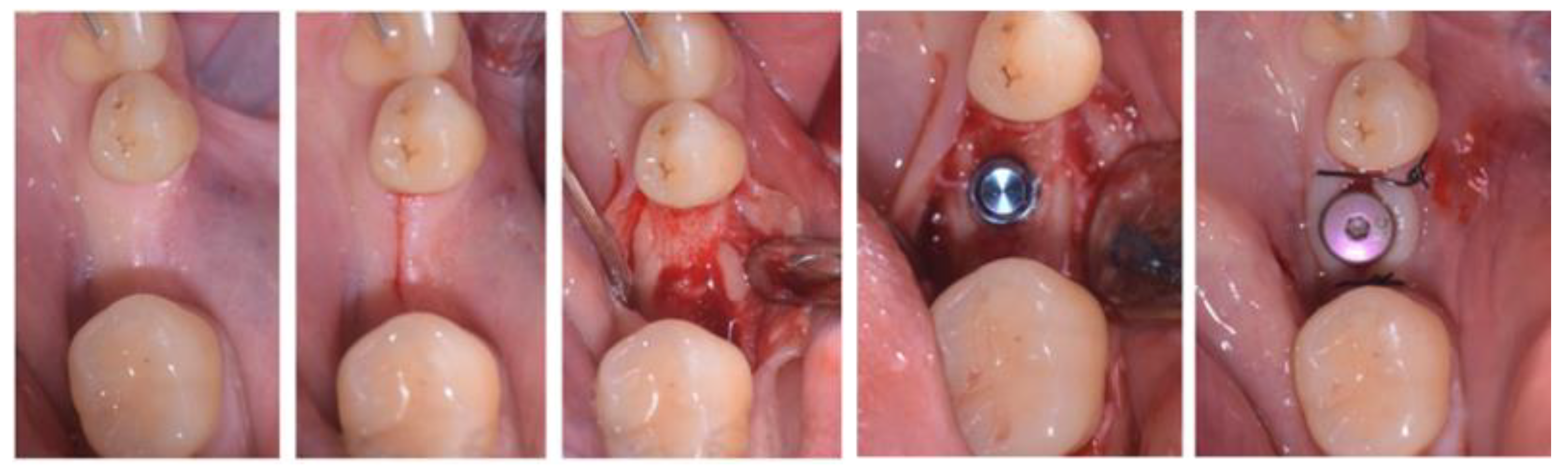 Applsci 13 09368 g004