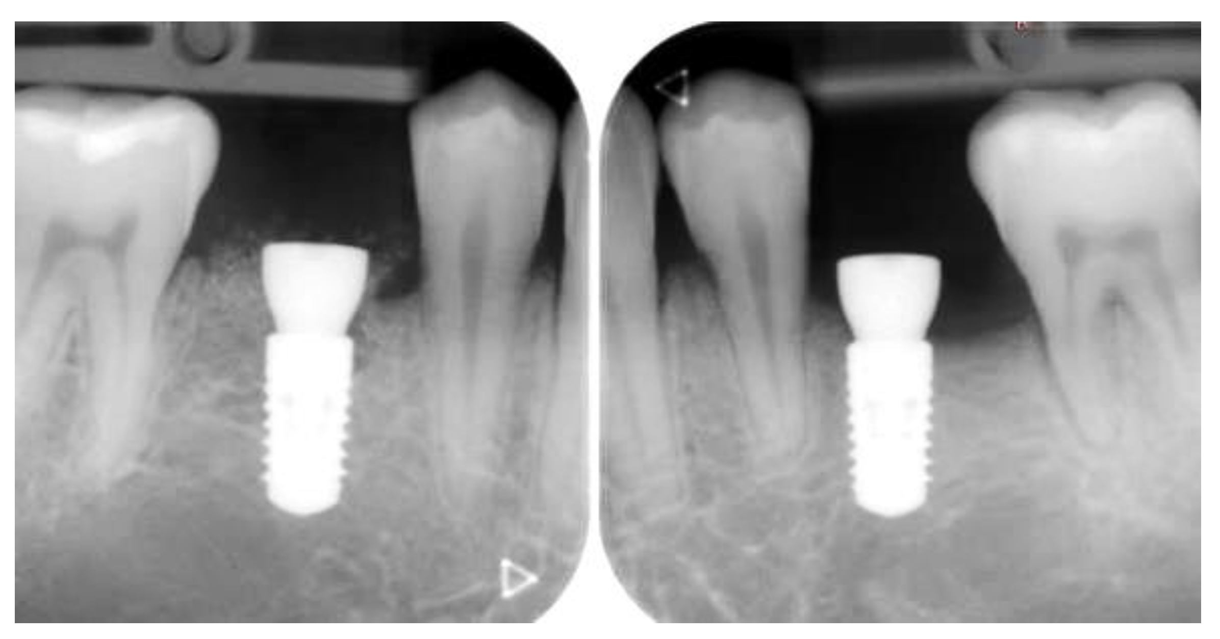 Applsci 13 09368 g005