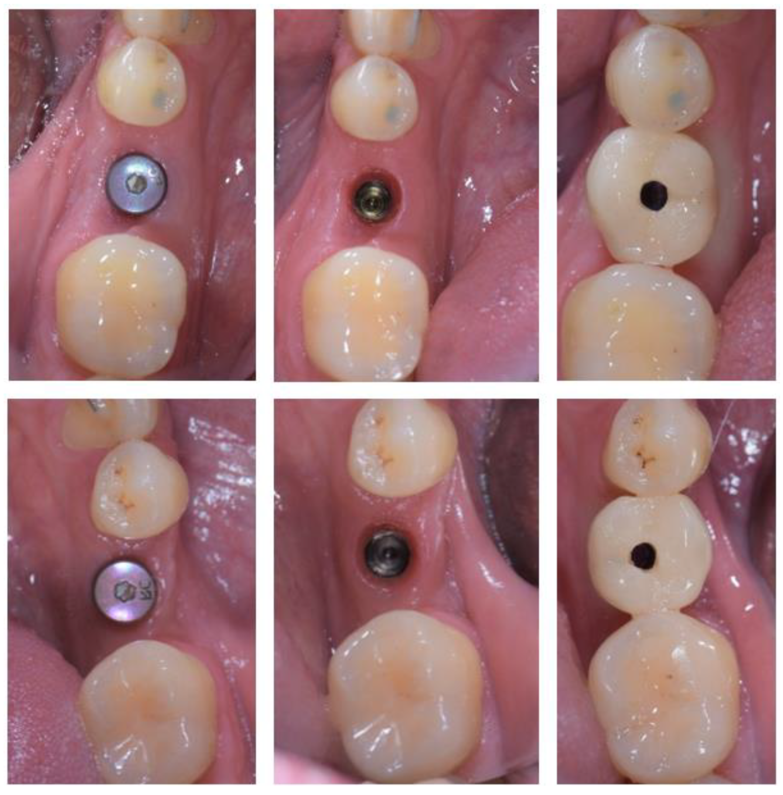 Applsci 13 09368 g006