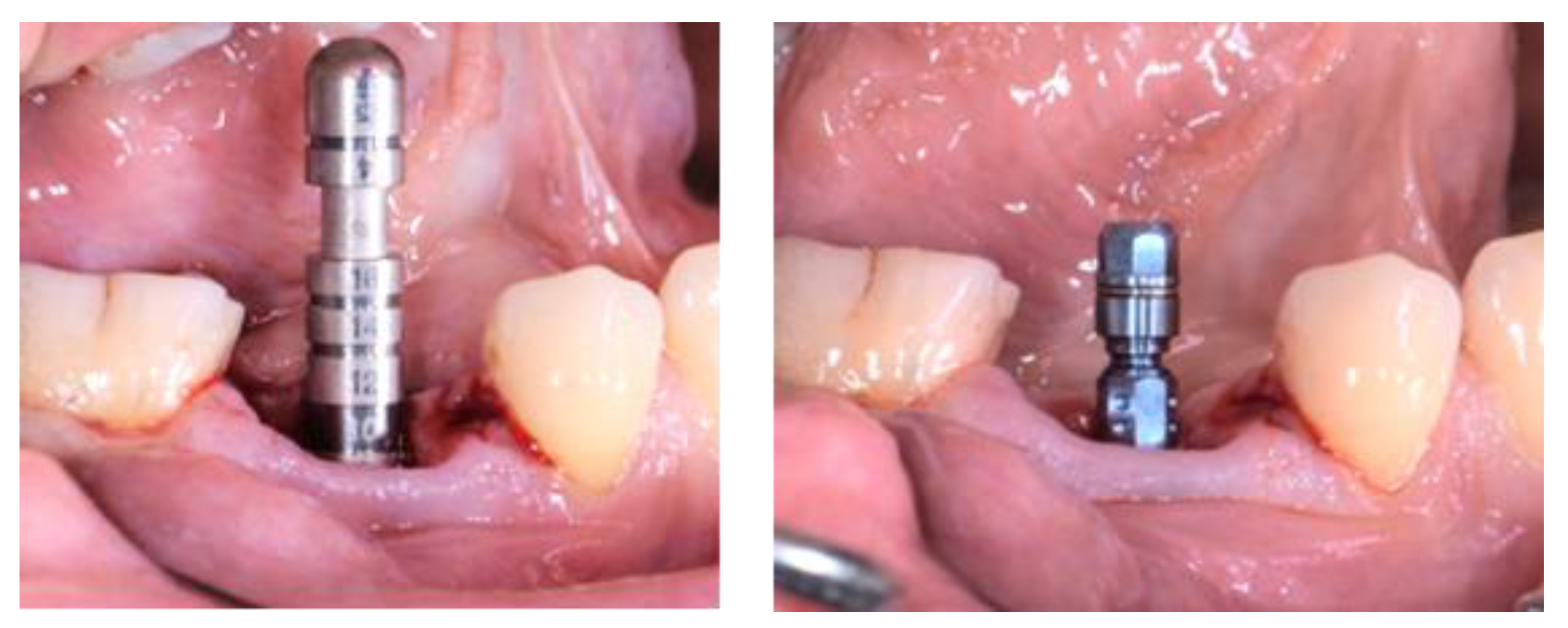 Applsci 13 09368 g013