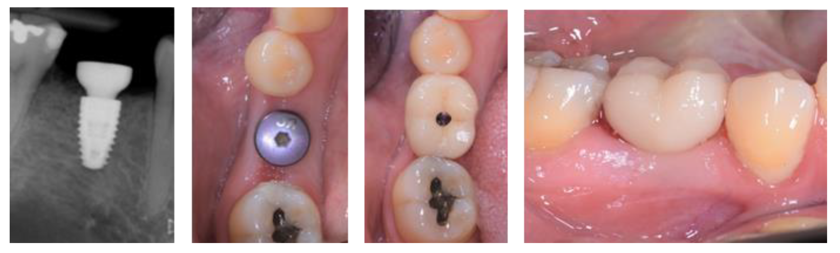 Applsci 13 09368 g014