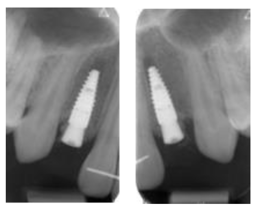 Applsci 13 09368 g025