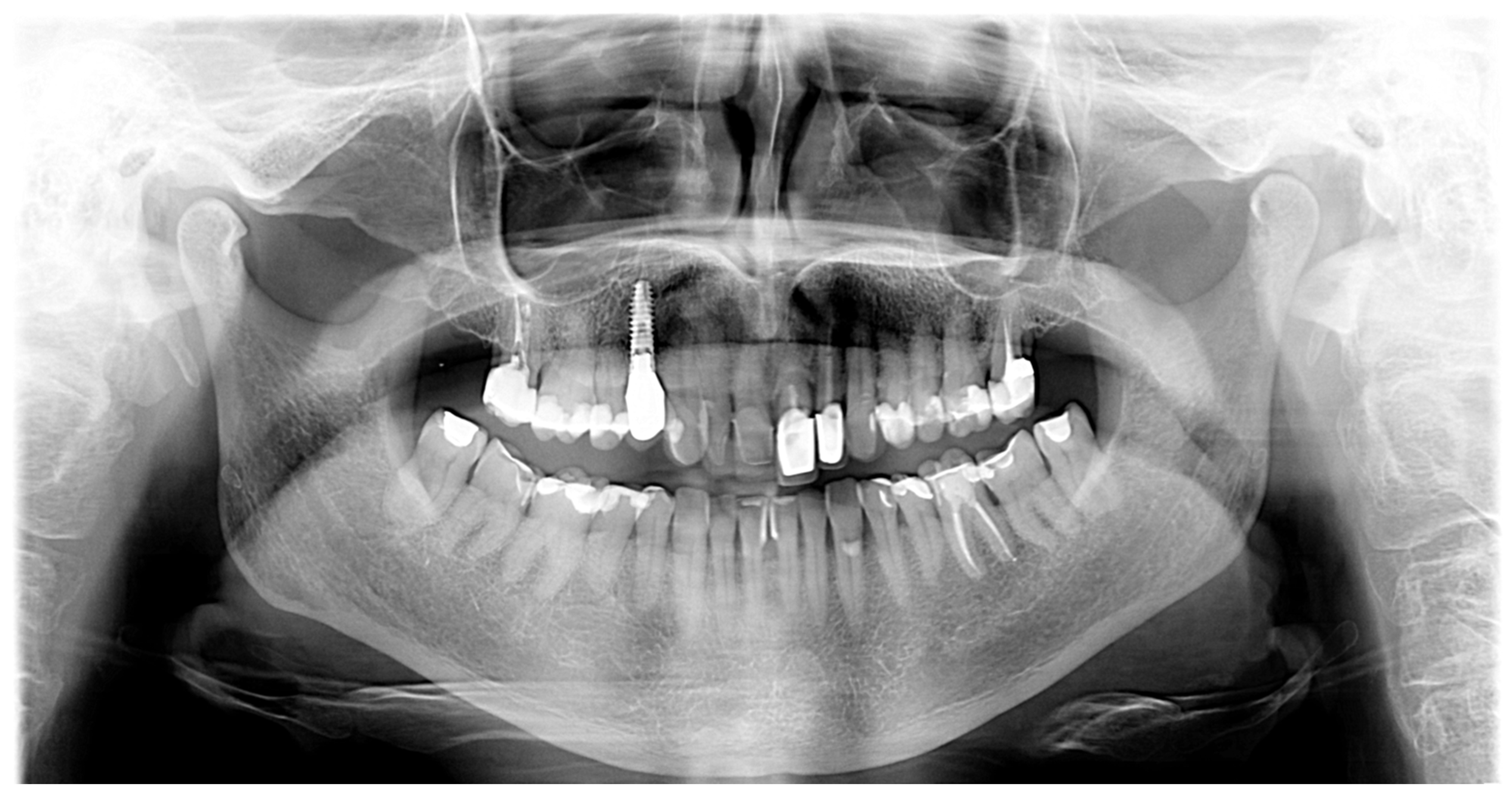 Applsci 13 09506 g005