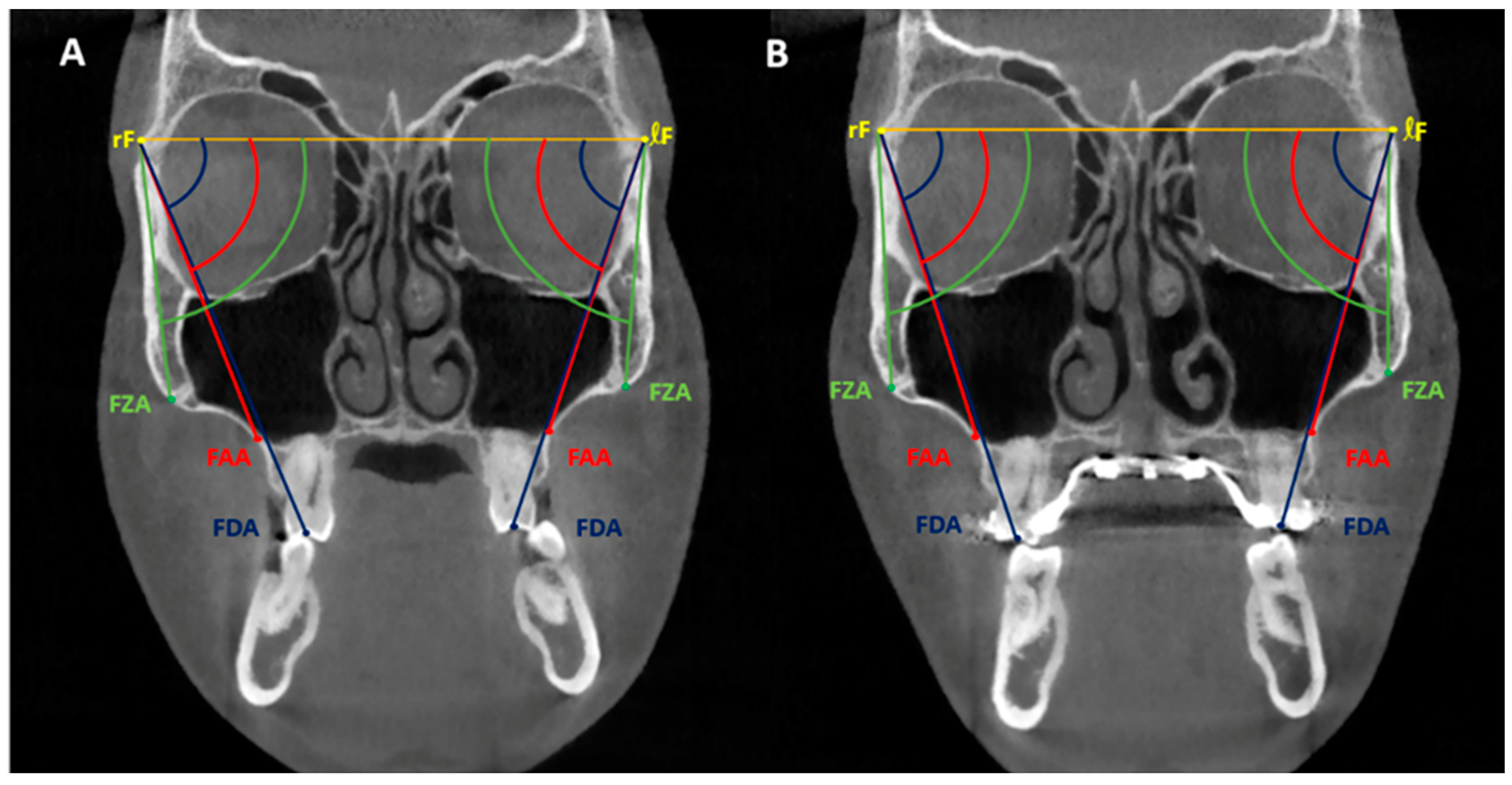 Applsci 13 09569 g003
