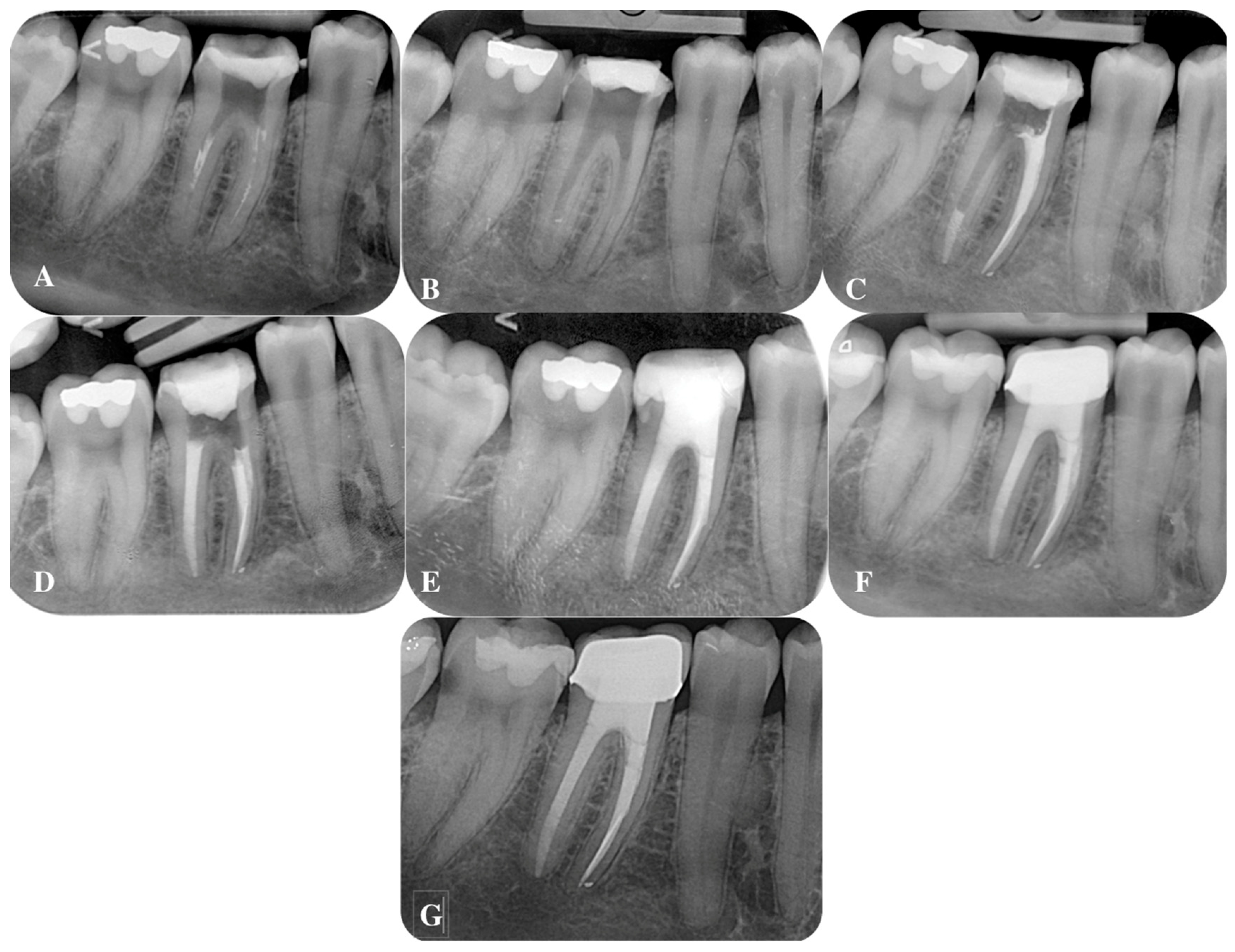 Applsci 13 09755 g003 Applsci 13 09755 g003