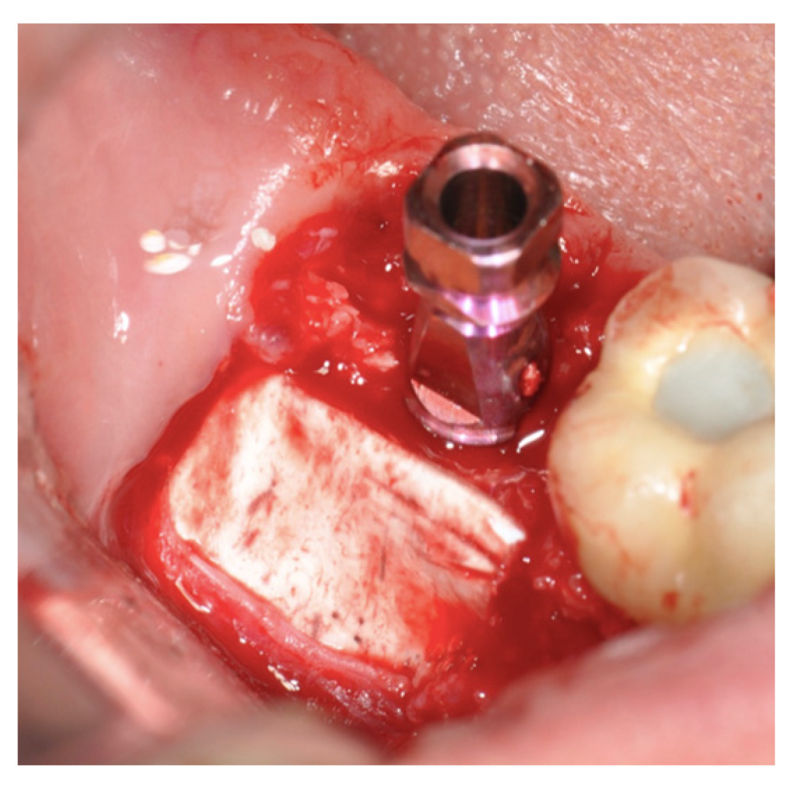 Applsci 13 10226 g007