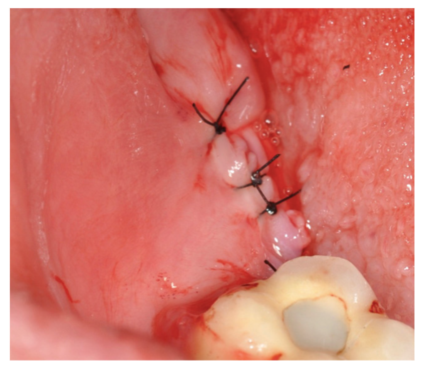 Applsci 13 10226 g008