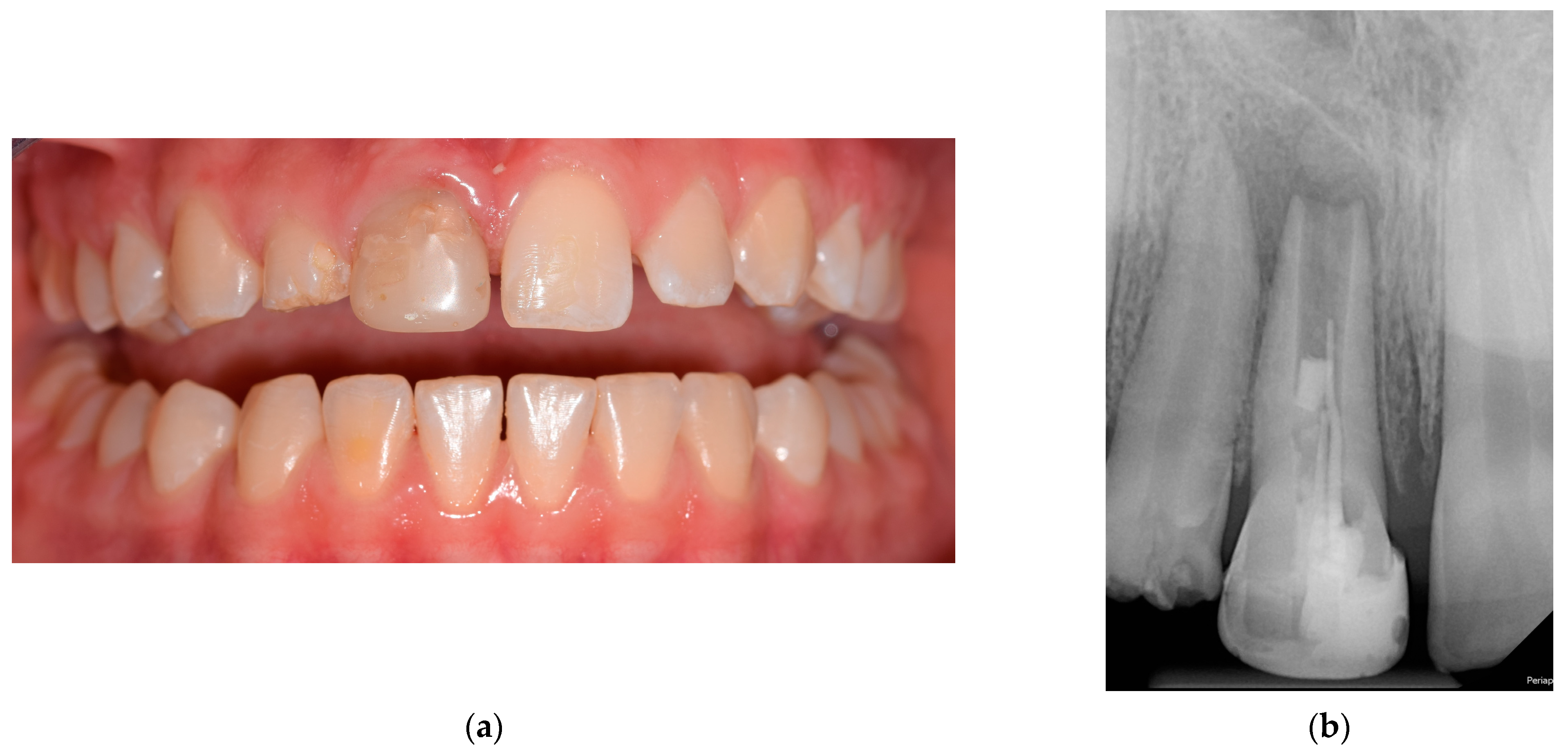 Applsci 13 10400 g001 Applsci 13 10400 g001