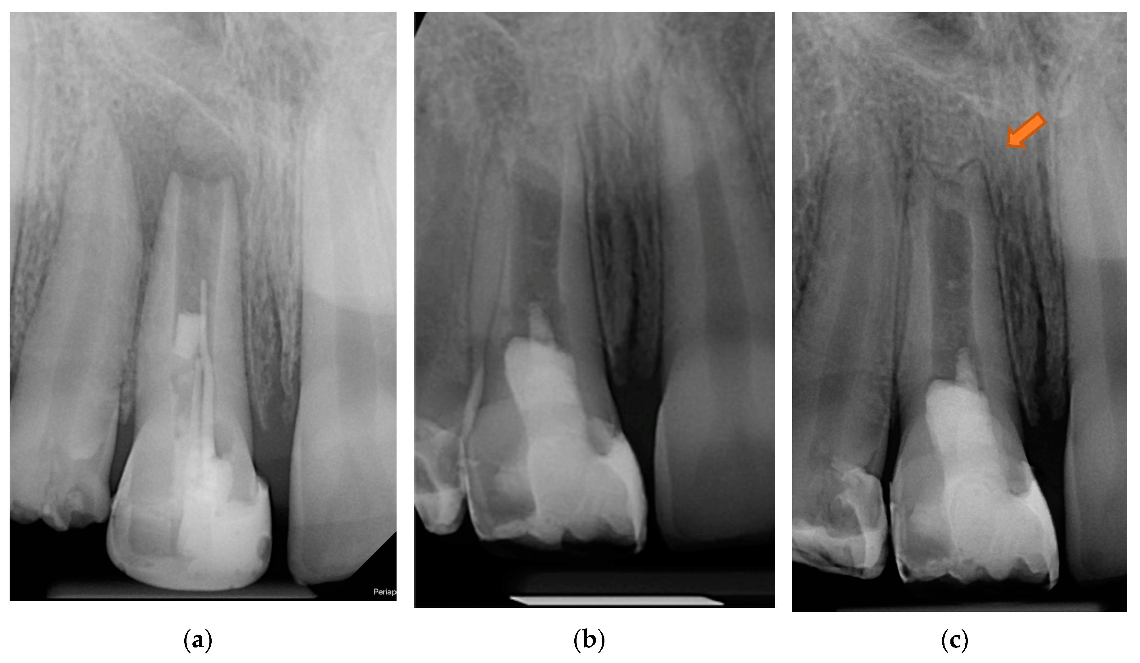 Applsci 13 10400 g006 Applsci 13 10400 g006