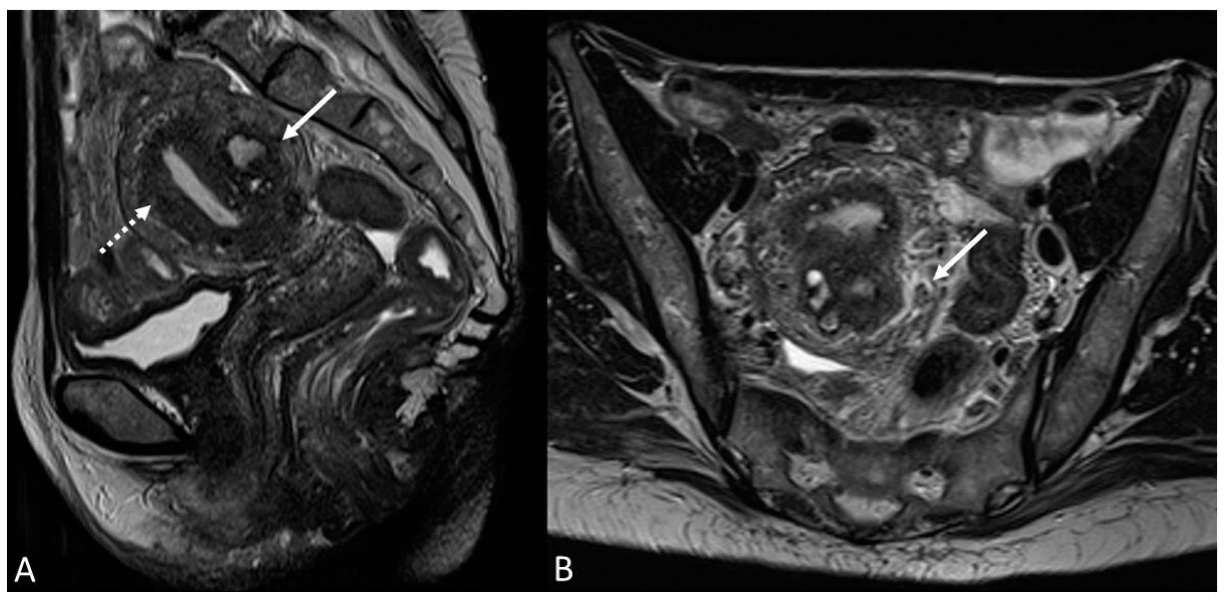 Applsci 13 10509 g011 Applsci 13 10509 g011