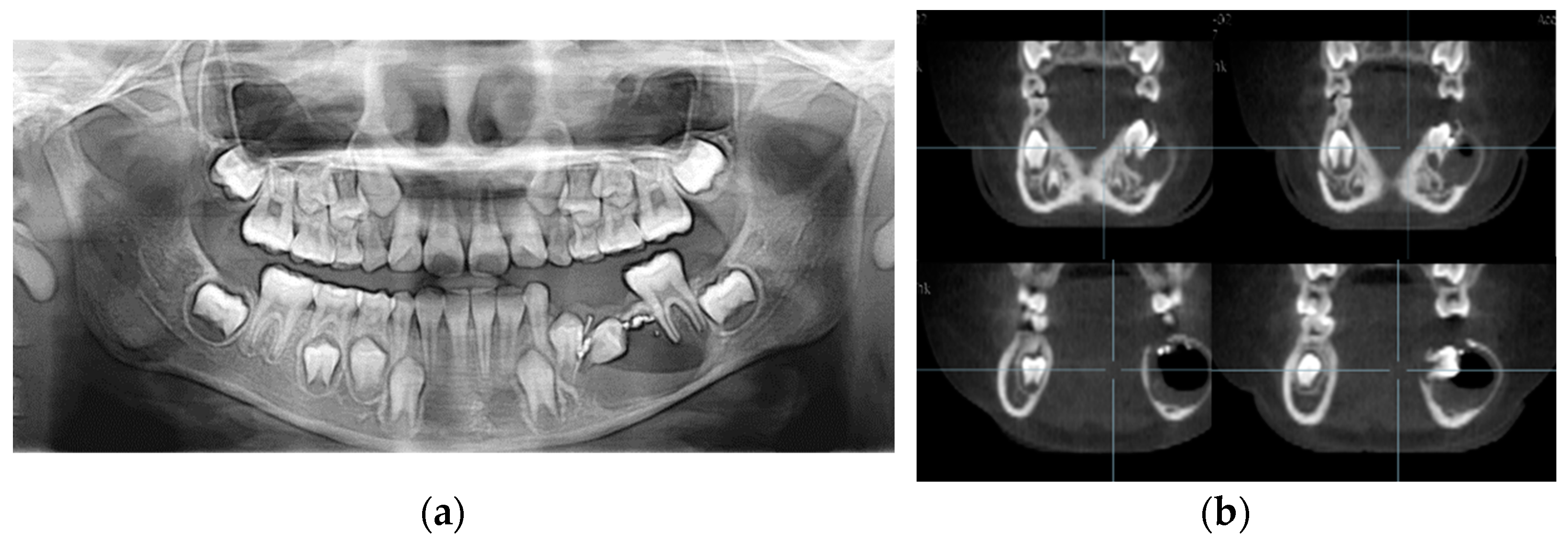 Applsci 13 11008 g004