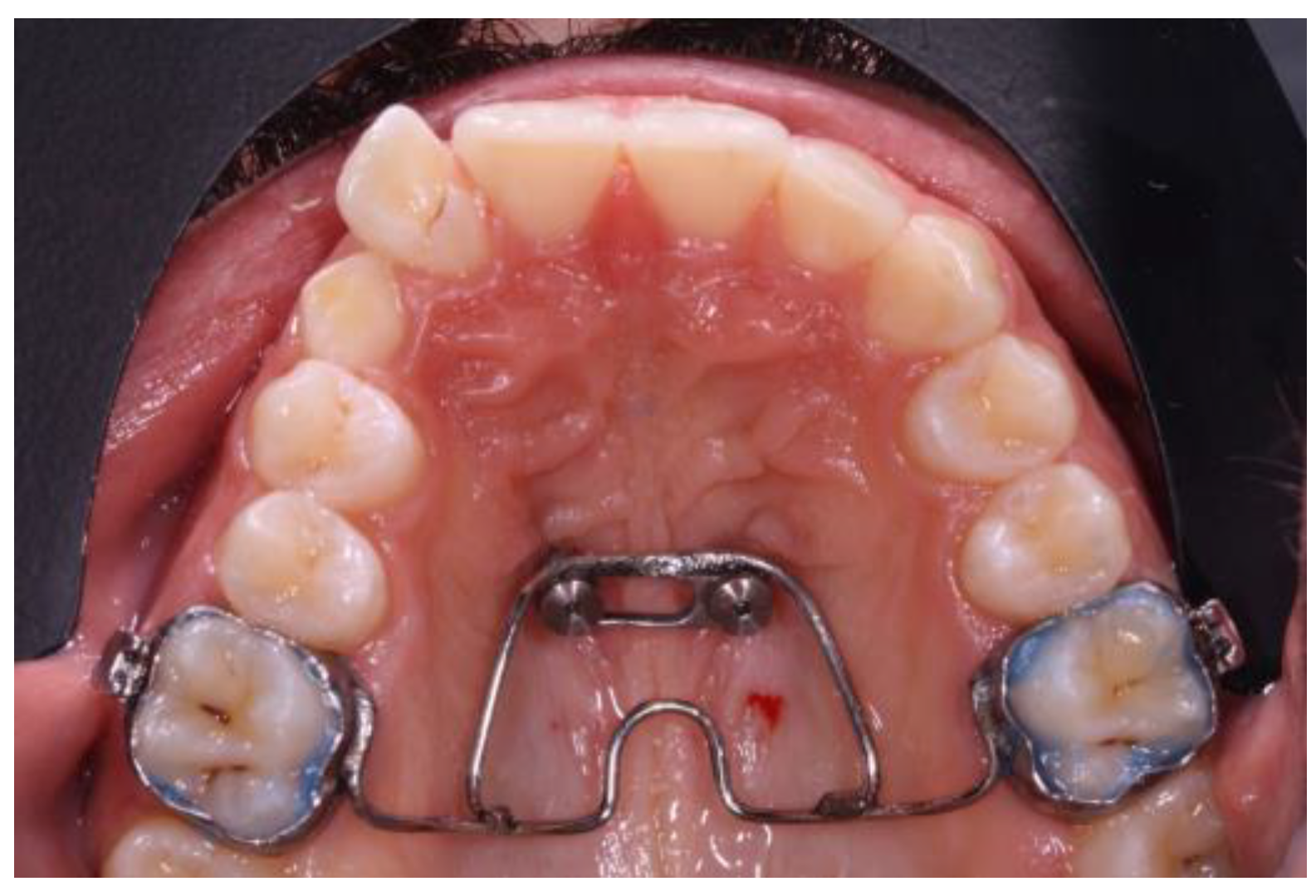 Applsci 13 11097 g002 Applsci 13 11097 g002