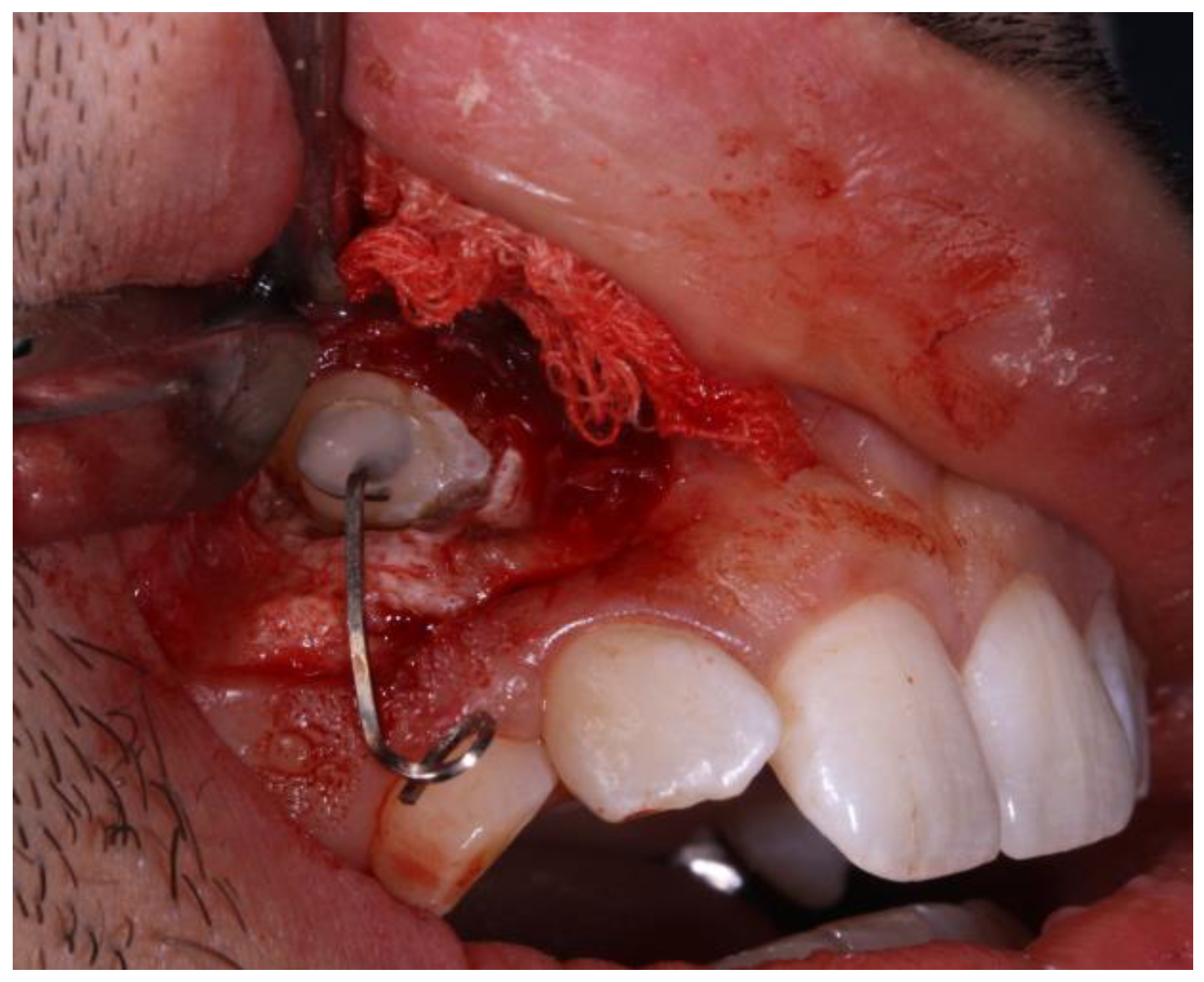 Applsci 13 11097 g011 Applsci 13 11097 g011