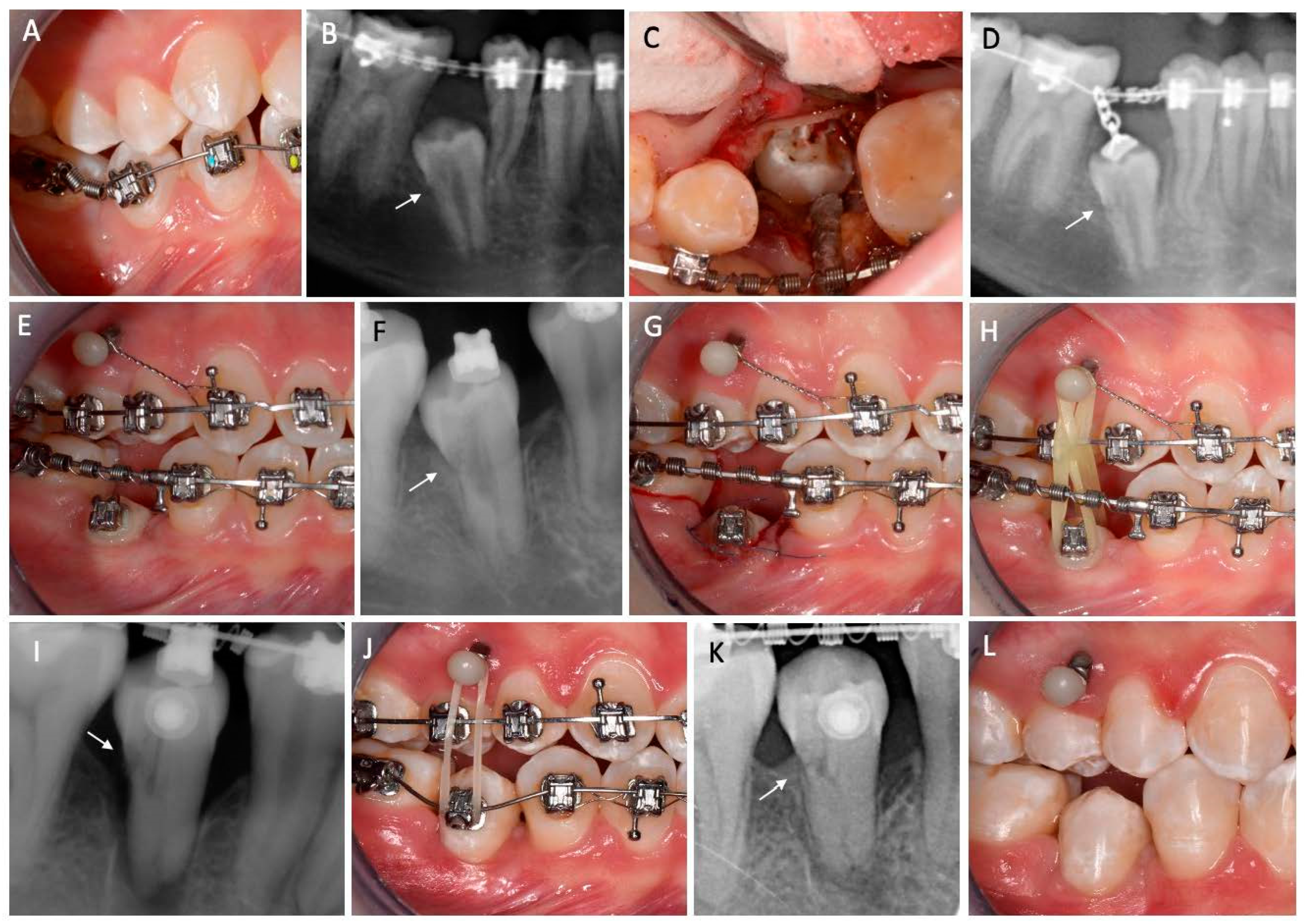 Applsci 13 11383 g002