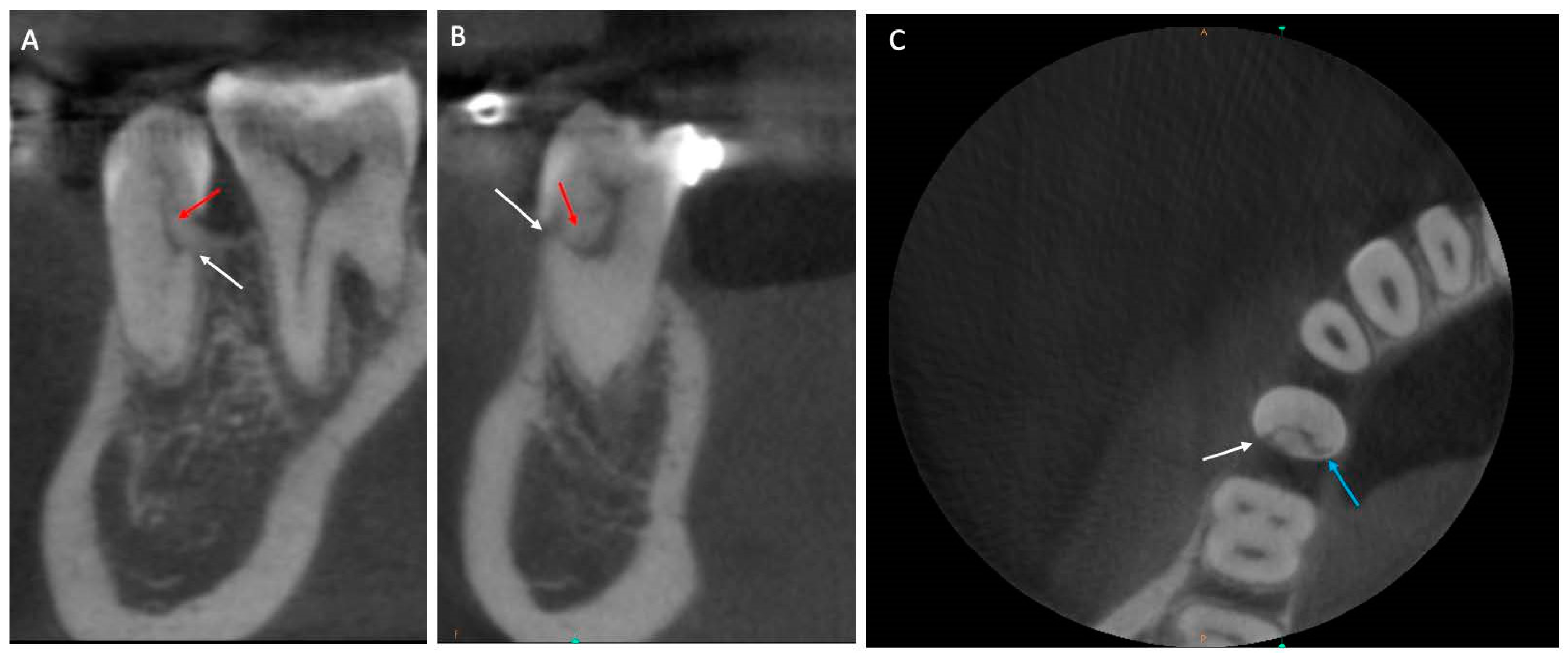 Applsci 13 11383 g003