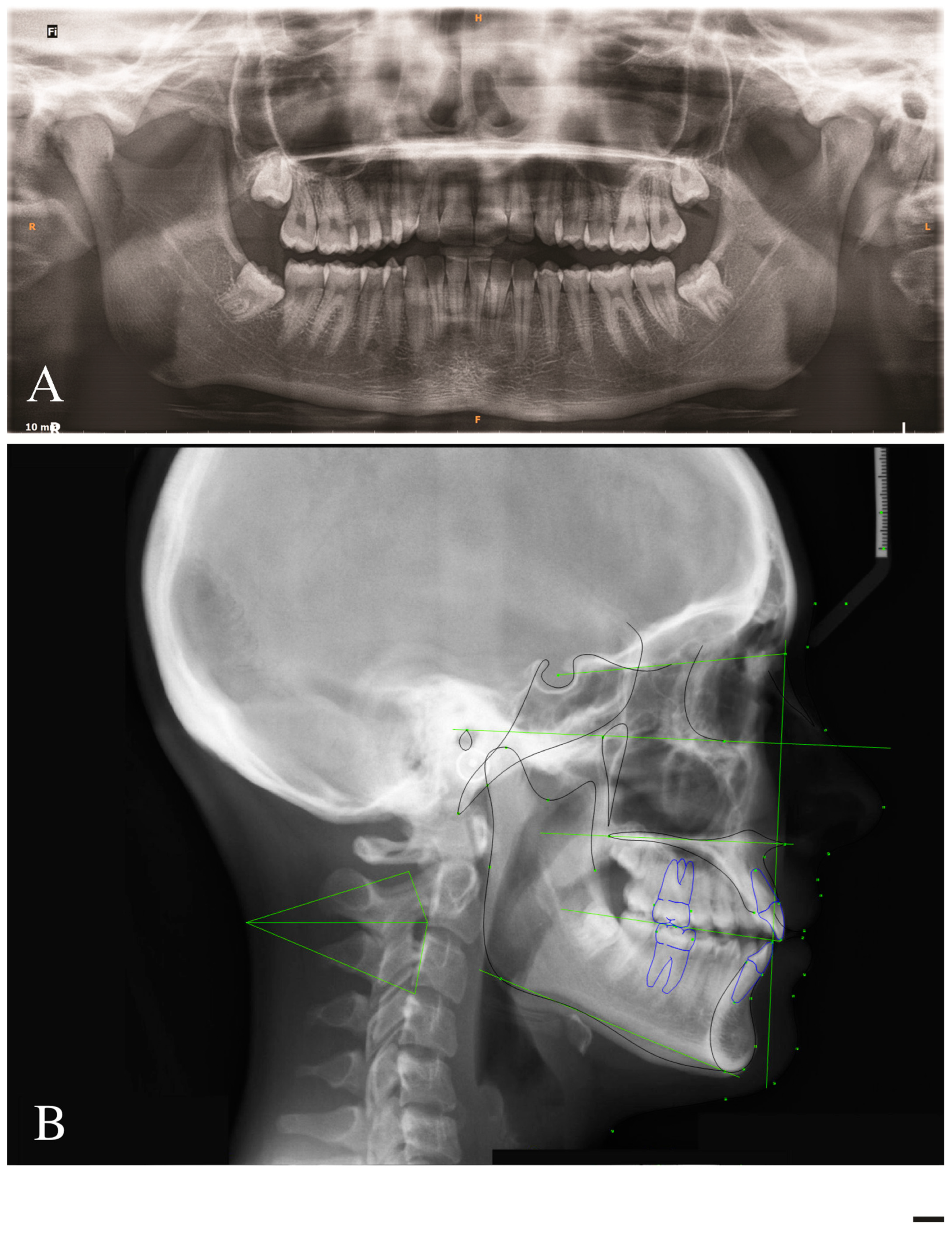 Applsci 13 11696 g002