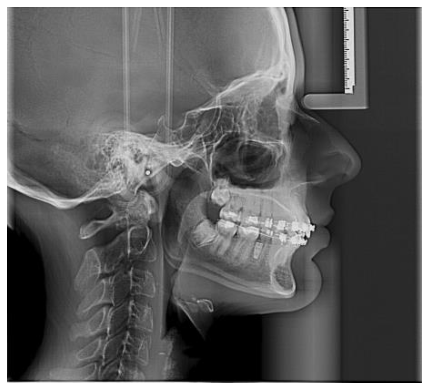 Applsci 13 12010 g011