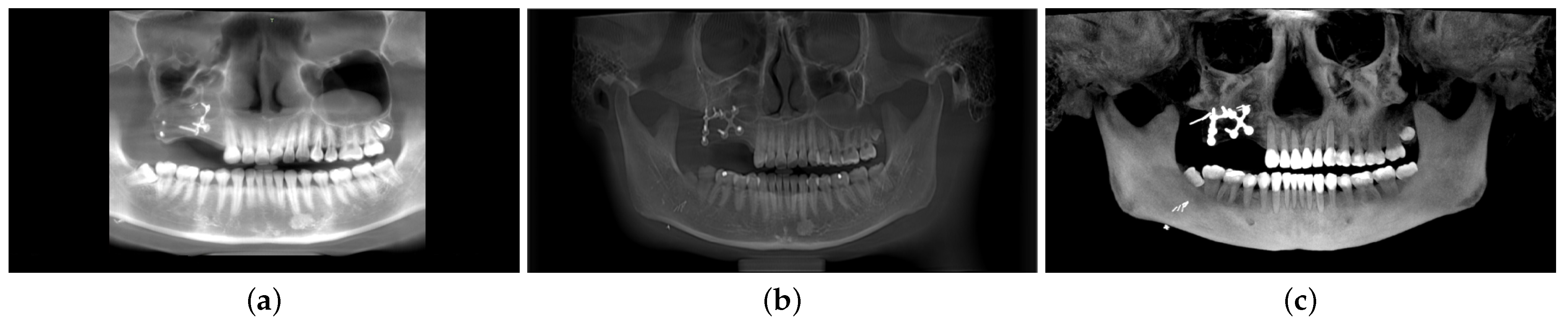 Applsci 13 12365 g007