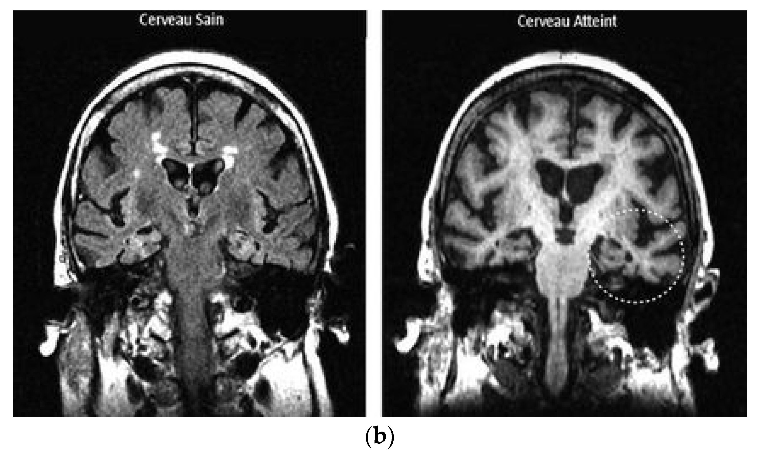 Applsci 13 13039 g006b