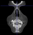 Applsci 14 00347 i004