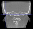 Applsci 14 00347 i012