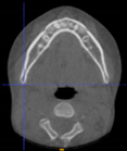 Applsci 14 00347 i015