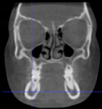 Applsci 14 00347 i024