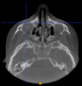Applsci 14 00347 i027