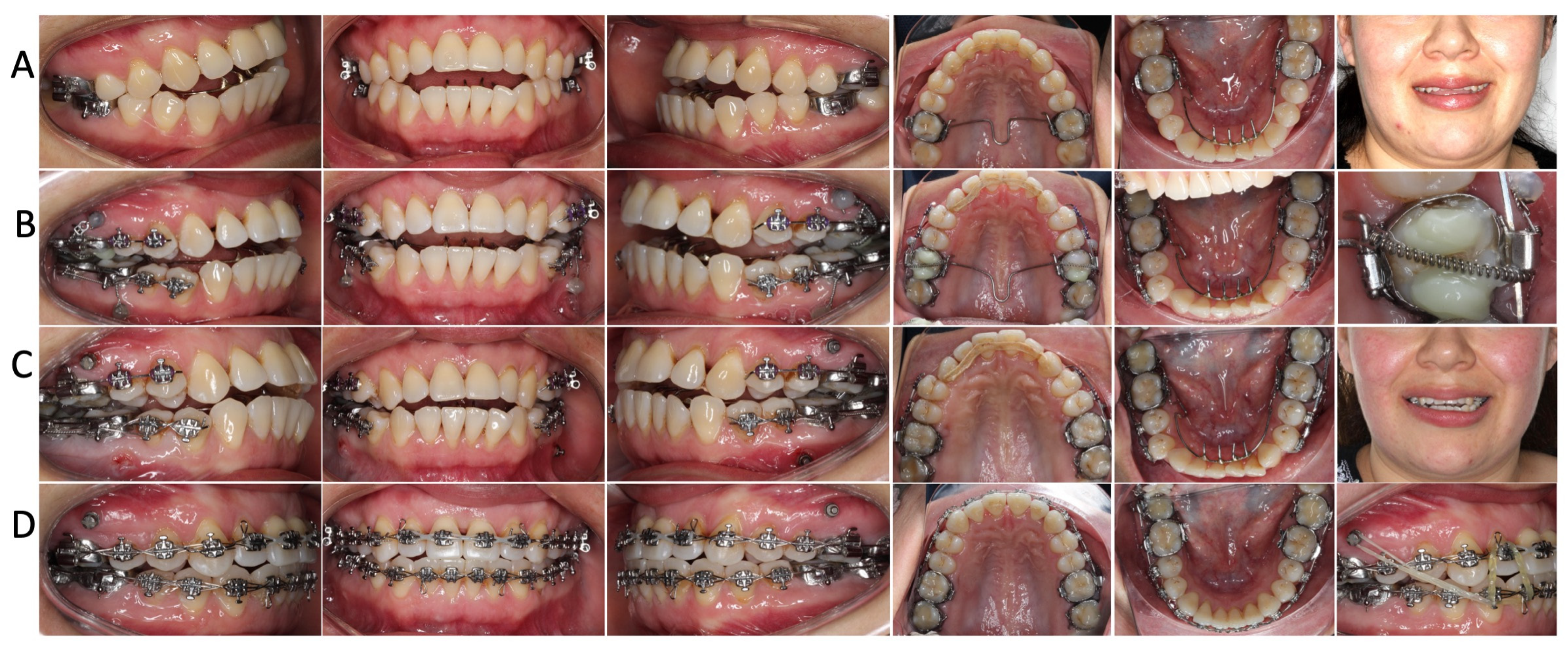 Applsci 14 00811 g004 Applsci 14 00811 g004