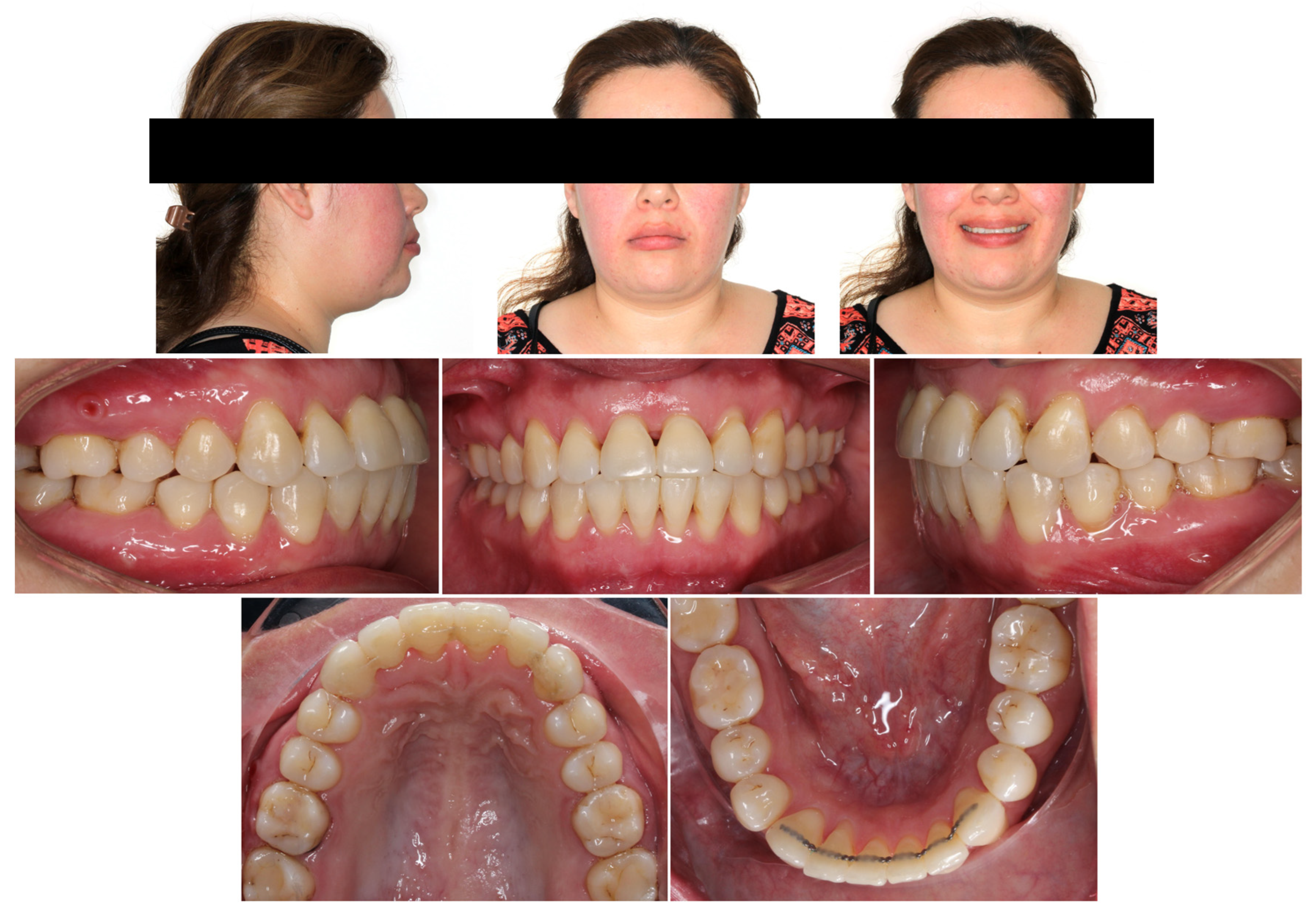 Applsci 14 00811 g005 Applsci 14 00811 g005