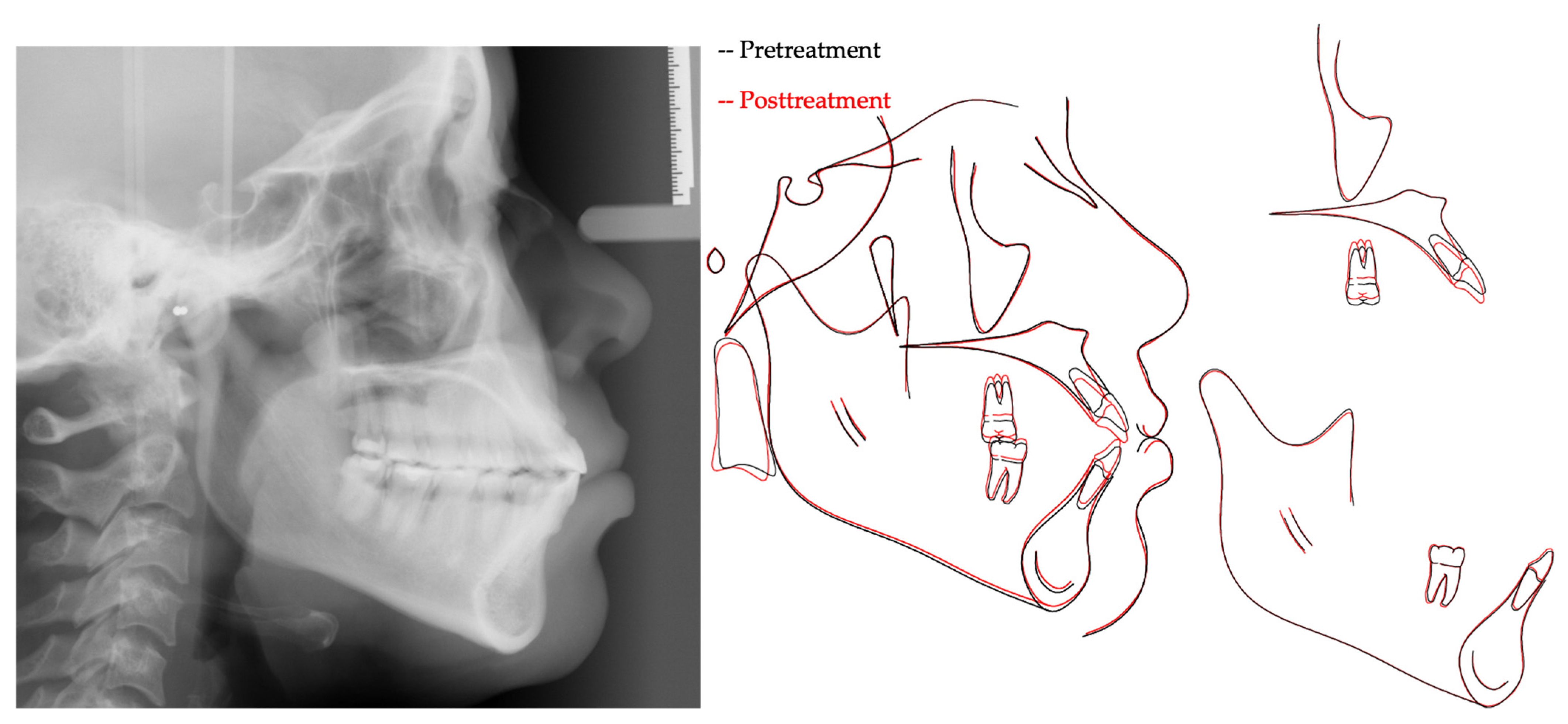 Applsci 14 00811 g006 Applsci 14 00811 g006
