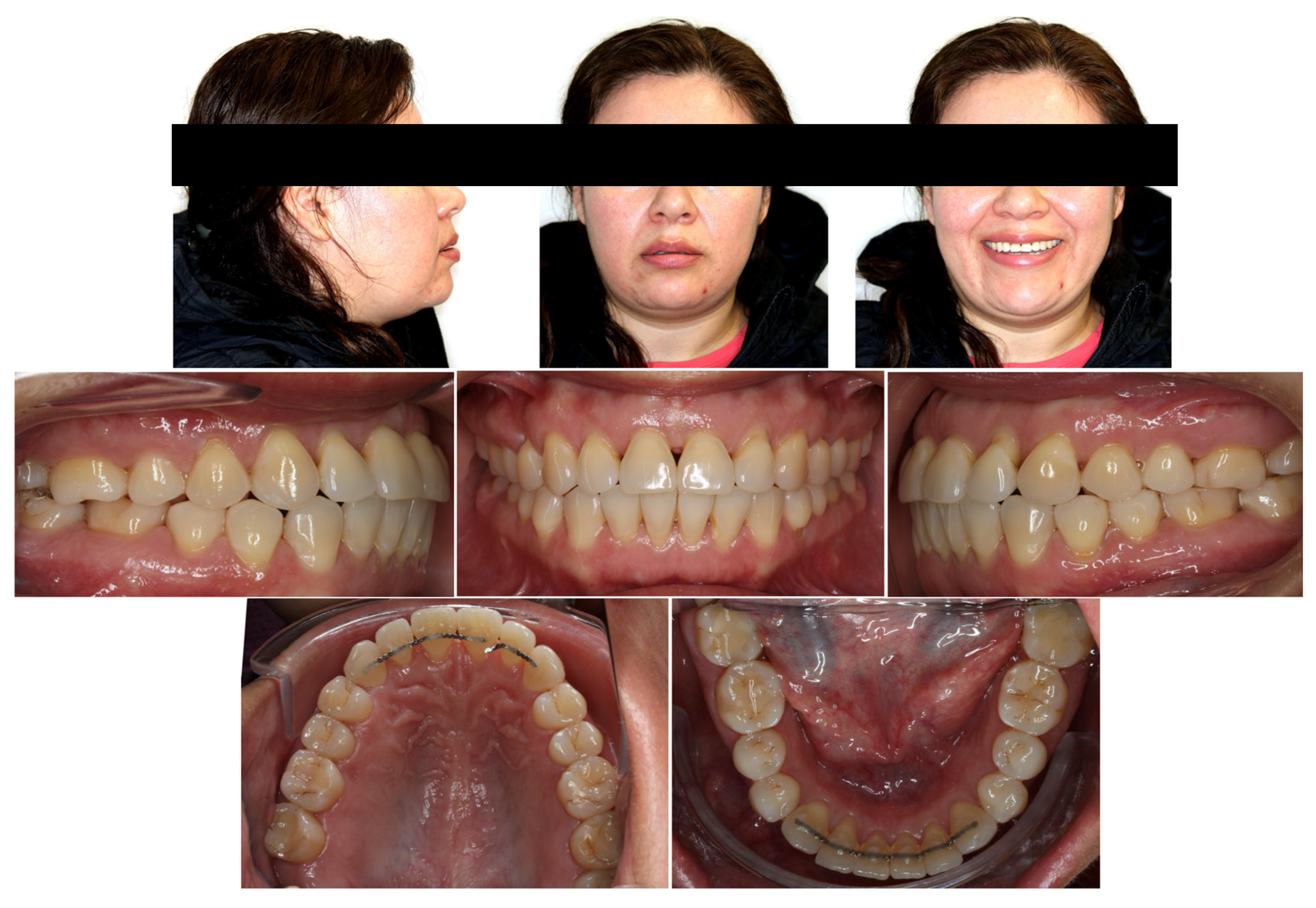 Applsci 14 00811 g008 Applsci 14 00811 g008