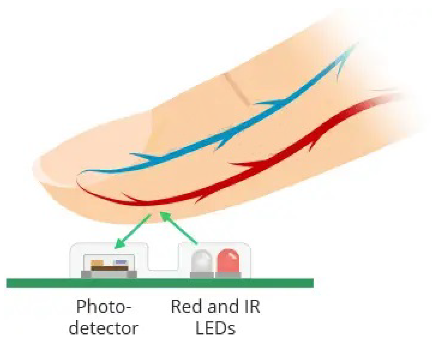 Applsci 14 01876 g005