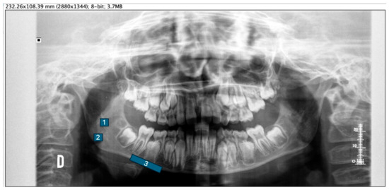 Applsci 14 01954 g001