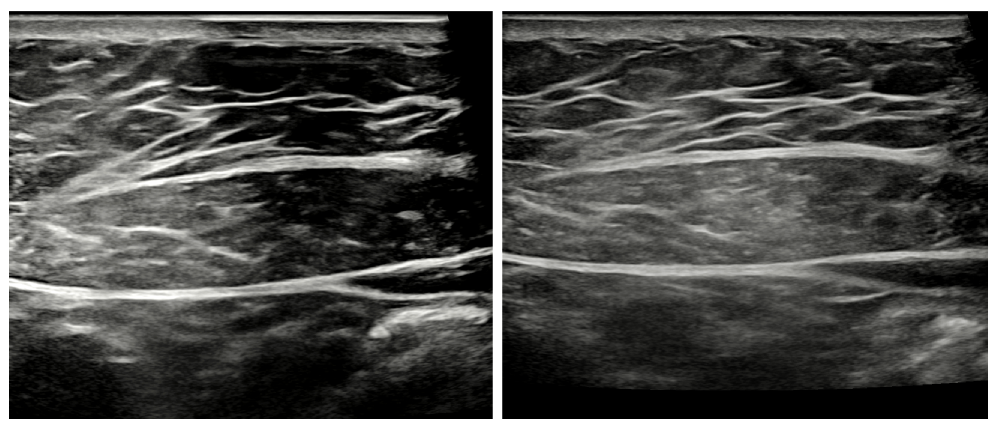 Applsci 14 02126 g002