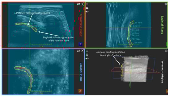 Applsci 14 02152 g0a1