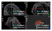 Applsci 14 02152 i023