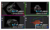 Applsci 14 02152 i039