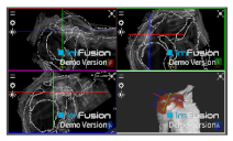 Applsci 14 02152 i057