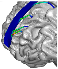 Applsci 14 02681 i018